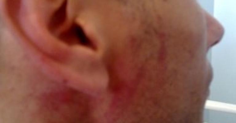 نقابة الممرضين تنظر برفع دعوى ضد المعتدين على الممرضين