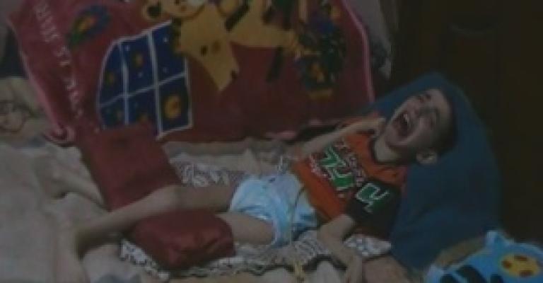 مرض غريب يفتك بثلاثة أطفال في الزرقاء "فيديو"