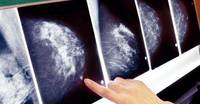 سرطان الثدي بين الرجال في الأردن ..حقيقة مغفلة