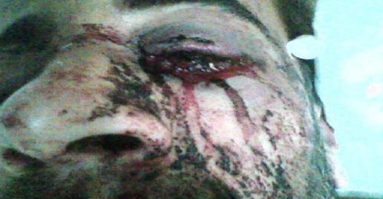  اعتداء رجال أمن على مواطن في الزرقاء.. ومديرية الأمن تفتح تحقيقا