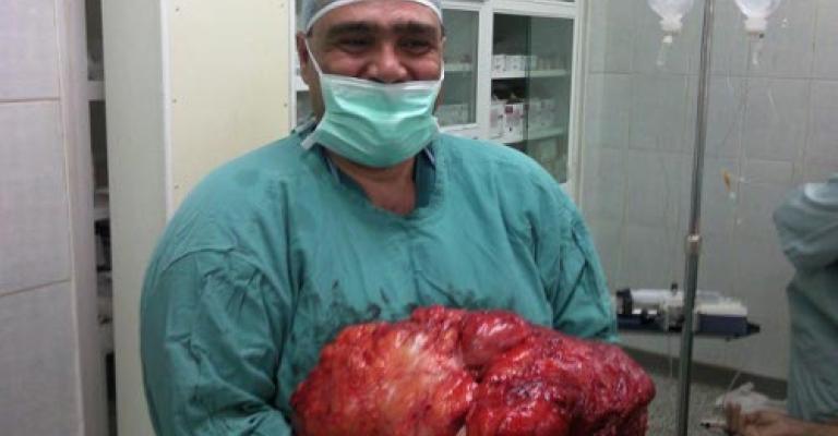 استئصال جسم غريب من بطن مريض وزنه 12 كيلوغراما استئصال جسم غريب من بطن مريض وزنه 12 كيلوغراما