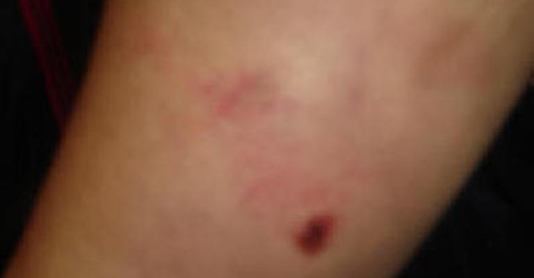 “ نجوى" ضحية التعذيب في يوم المرأة العالمي