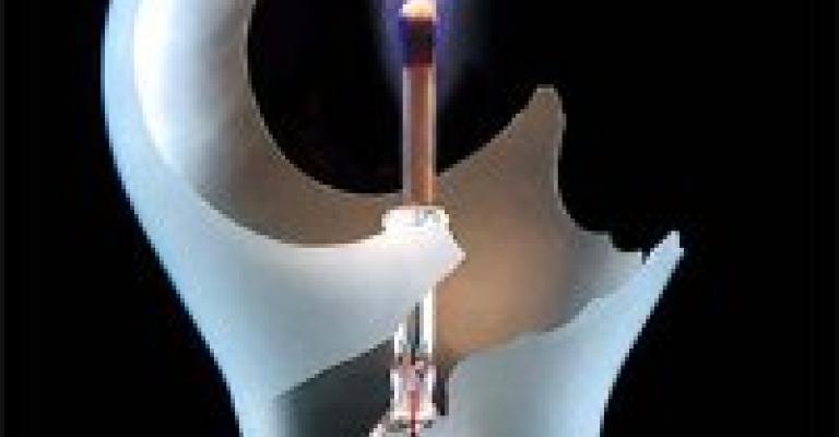 المتقشّفون الجدد