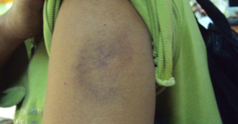 عاملة منزل تلجأ لراديو البلد هربا من معاملة مخدوميها