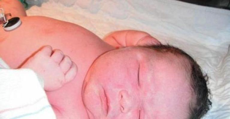 الدفاع المدني يجري عملية ولادة لسيدة في منزلها