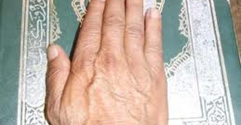 "الأولاني والتيلاني