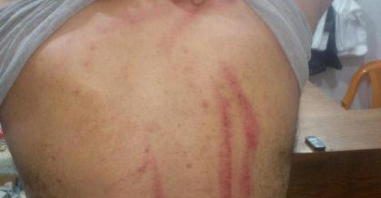 ناشط يُجابه بقنابل غاز والأمن يؤكد حق الاستخدام 