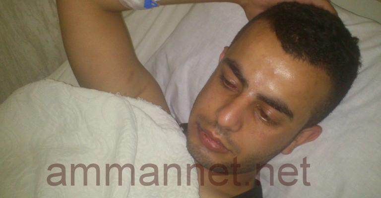 صور- الامن يعتدي على شاب في اربد