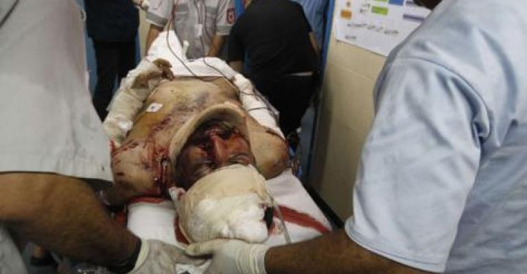  شهيدان بغارتين للاحتلال على غزة 