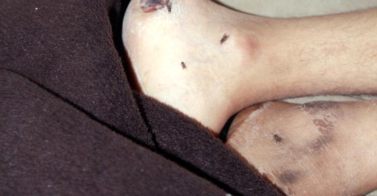 مرض خوله يحطم أحلام عائلتها