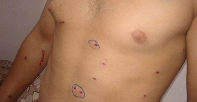 مناشدات من مخيم غزّة لوقف اعتقال المصابين والغاز المسيل للدموع مناشدات من مخيم غزّة لوقف اعتقال المصابين والغاز المسيل للدموع