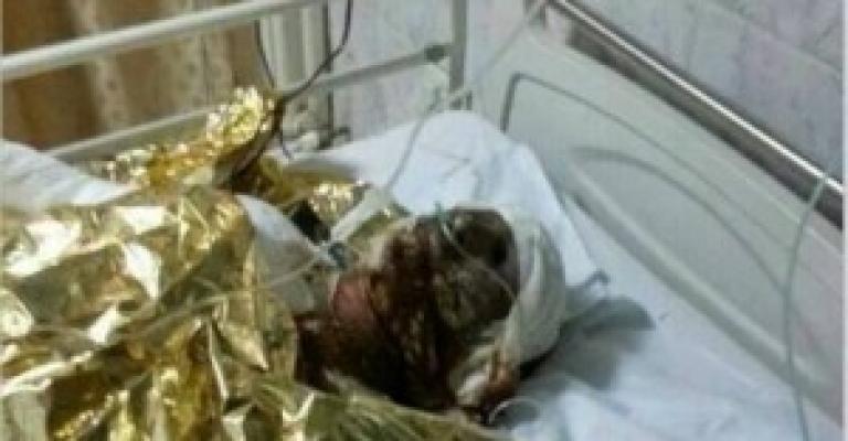 إصابة 3 أطفال سوريين ووالدهم إثر حريق في الزعتري إصابة 3 أطفال سوريين ووالدهم إثر حريق في الزعتري