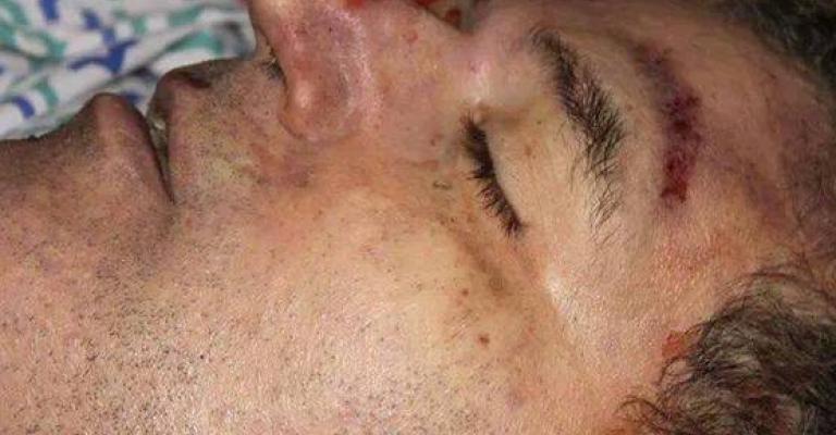 تحقيقات الجيش الإسرائيلي: الزعيتر حاول انتزاع سلاح و"خنق" جندي إسرائيلي