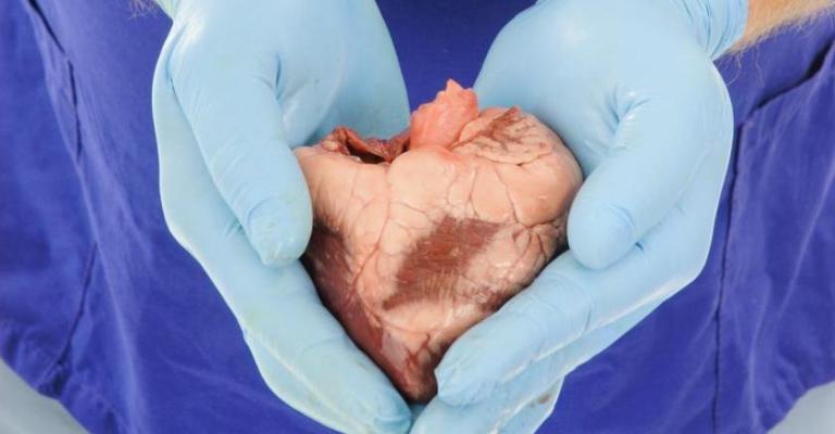 التبرع بالأعضاء.. "ومن أحياها فكأنما أحيا الناس جميعا"