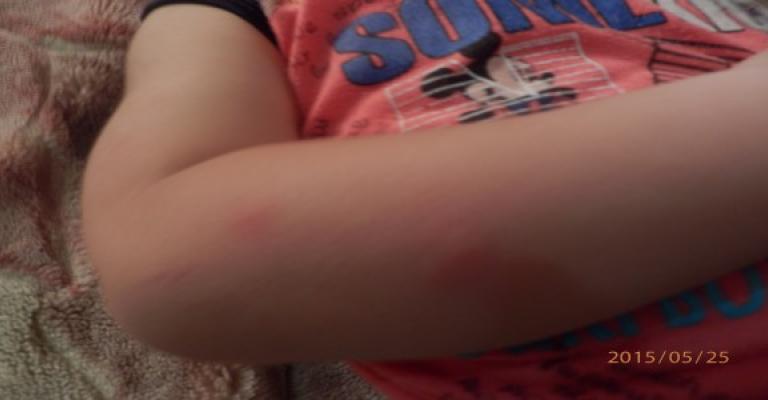 الحشرات تقض المضاجع بالهاشمية والبلدية تنفي التقصير بمكافحتها