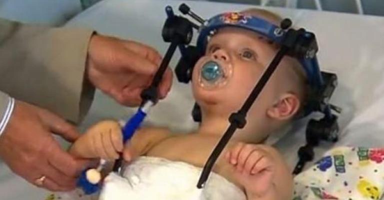 معجزة طبية.. إعادة رأس رضيع فصله حادث سير معجزة طبية.. إعادة رأس رضيع فصله حادث سير