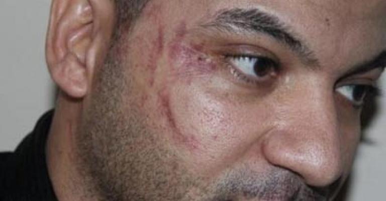 قضية العامل المصري... السفارة تتجه للقضاء من جديد