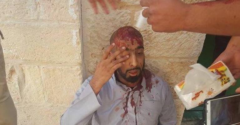 إصابات واعتقالات باقتحام مستوطنين وشرطة الاحتلال للأقصى