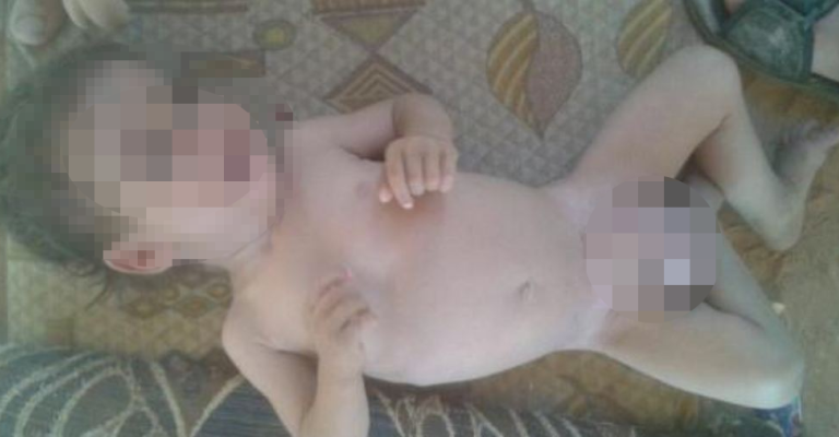 حالة طارئة لطفل في "الركبان" تحتاج جراحة عاجلة والصليب الأحمر: لا نسطيع الدخول حالة طارئة لطفل في "الركبان" تحتاج جراحة عاجلة والصليب الأحمر: لا نسطيع الدخول