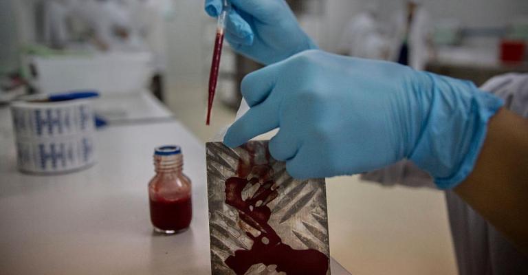 "ليزر الدماء" للعثور على الأورام في الجسم "ليزر الدماء" للعثور على الأورام في الجسم