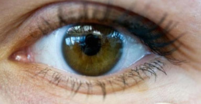 اطلاق حملة مكافحة فقدان البصر في السلط اطلاق حملة مكافحة فقدان البصر في السلط