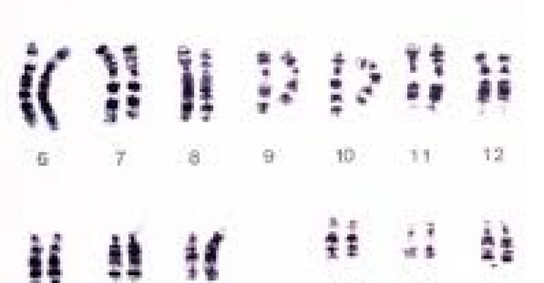 اليوم الوطني لمتلازمة داون .. تحت شعار (منقدر)