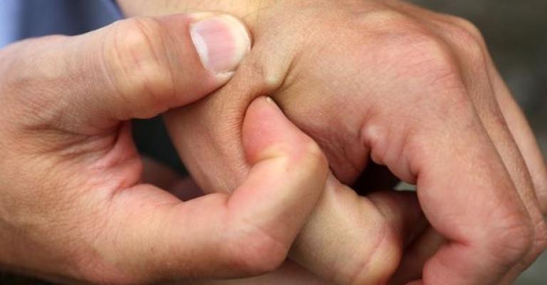 شركة توفر خيار زرع شريحة داخل أيدي موظفيها شركة توفر خيار زرع شريحة داخل أيدي موظفيها