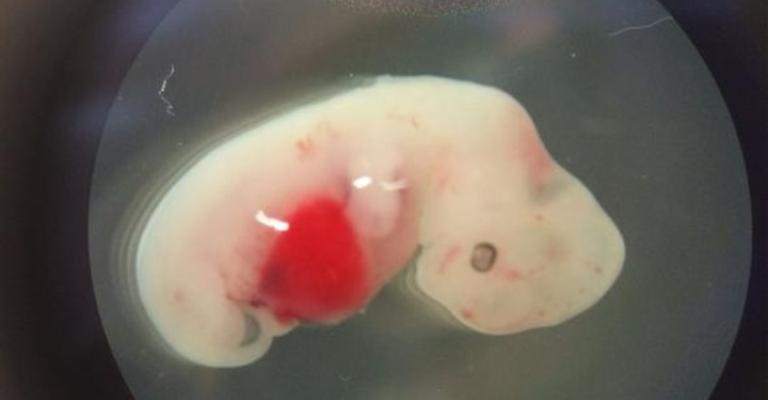 أول هجين من البشر والأغنام.. هذا تأثيره على علاج السكري