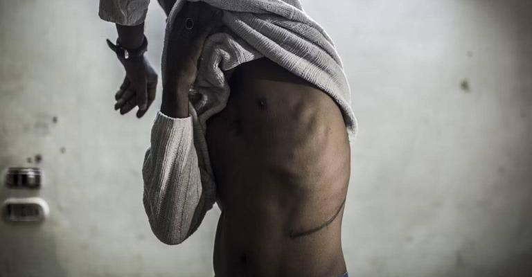 Archive: A Sudanese man testified that he sold his kidney to organ traffickers in 2017. Archive: A Sudanese man testified that he sold his kidney to organ traffickers in 2017.