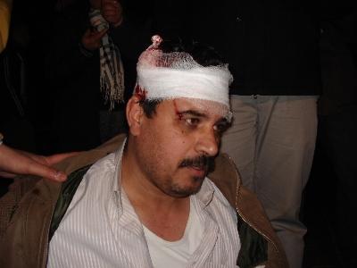 المستشفيات المحيطة بالداخلية تستقبل عشرات الإصابات بعضها خطيرة 