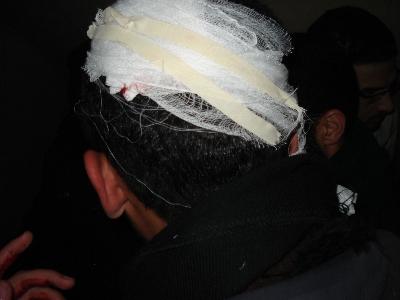 المستشفيات المحيطة بالداخلية تستقبل عشرات الإصابات بعضها خطيرة 