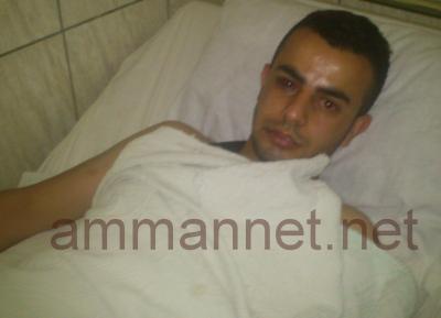 صور- الامن يعتدي على شاب في اربد