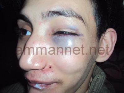 عام على زيارة الملك لمراكز المعاقين .. الانتهاكات مستمرة!