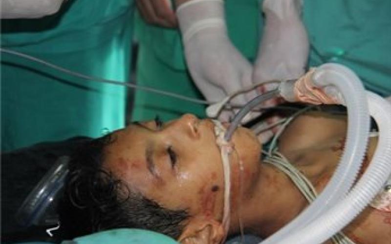 سبعة شهداء بينهم خمسة اطفال في سلسلة غارات على القطاع