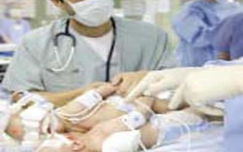 نجاح عملية فصل التوأم الأردني في السعودية