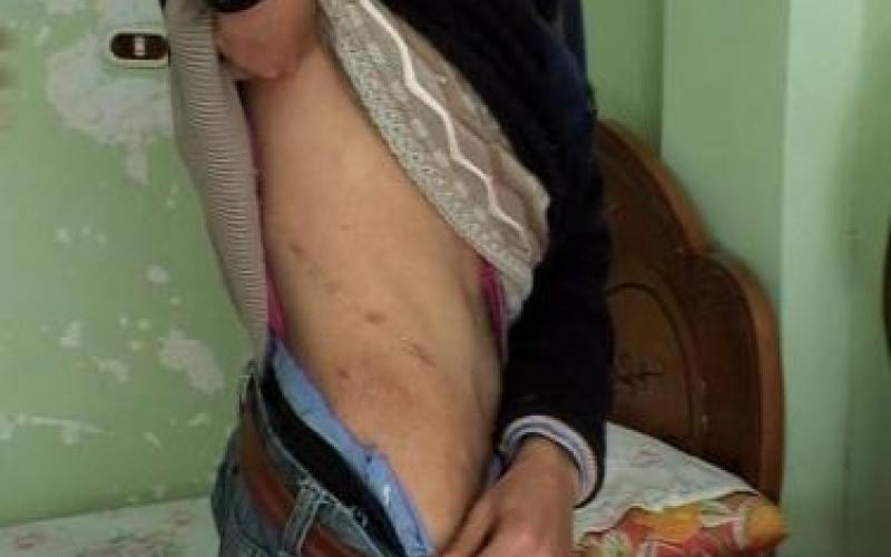 الأردن يتسلم مواطنا متهما بالاتجار بالاعضاء البشرية