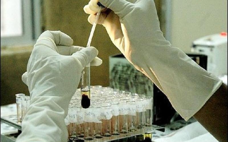 إخلاء مبنى في جامعة اليرموك بعد تفاعلات كيميائية