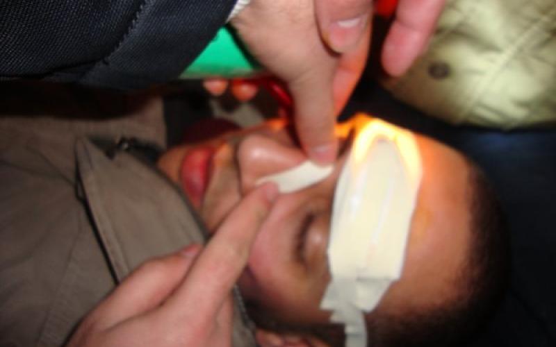 المستشفيات المحيطة بالداخلية تستقبل عشرات الإصابات بعضها خطيرة 