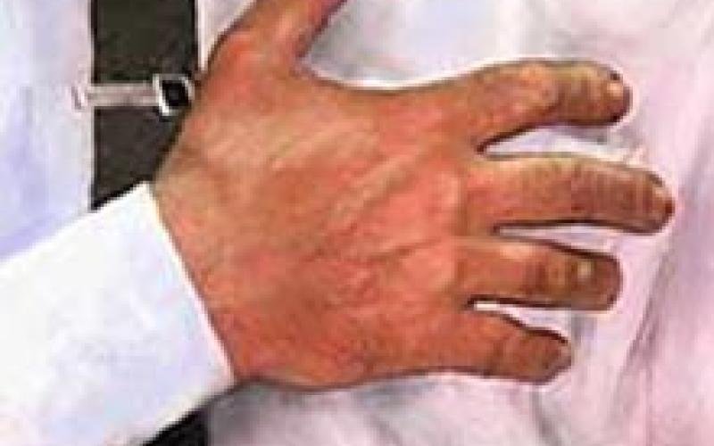 أحد الوزراء يصاب بذبحة صدرية