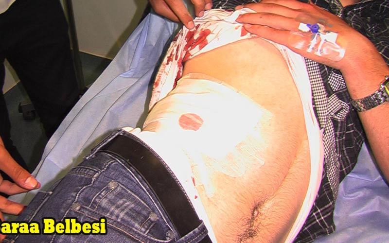 حالة المصاب في الإسلامي مستقرة ونقل مصاب البقعة الى المدينة الطبية