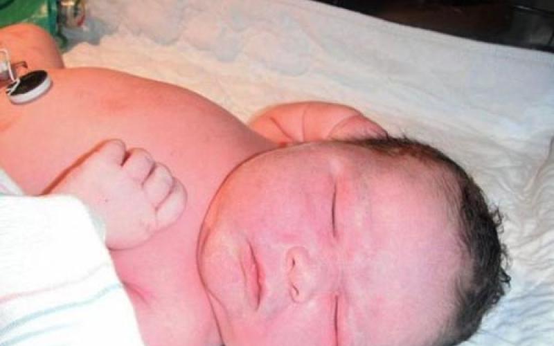 الدفاع المدني يجري عملية ولادة لسيدة في منزلها