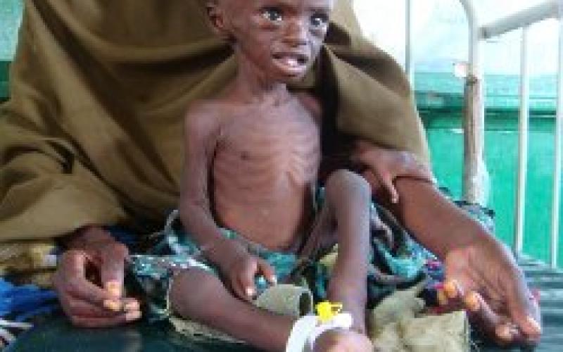 وفد طبي اردني يتوجه إلى الصومال