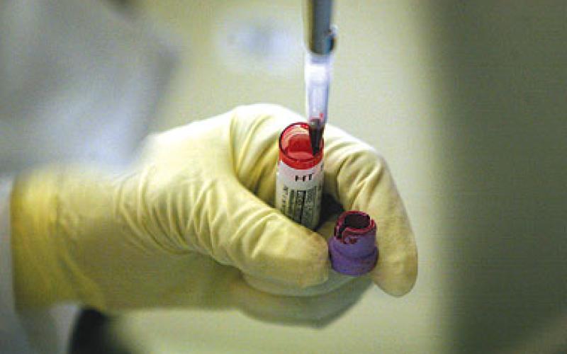 نتائج فحوصات المرض الغامض تظهر الثلاثاء