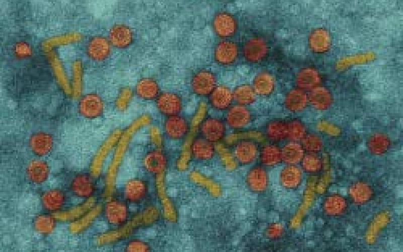 خزانات مياه ملوثة تنشر الكبد الوبائي a” بين طلبة المدارس