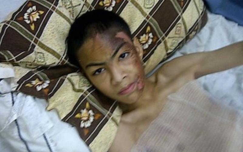 اعتداءات جسدية ولفظية على أشخاص ذوي إعاقة داخل دور رعاية خاصة