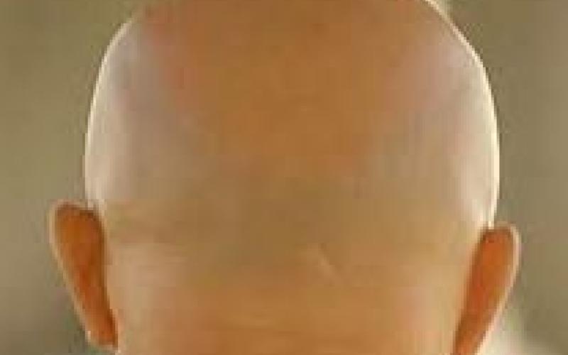 حروف "العلة" الرسمية