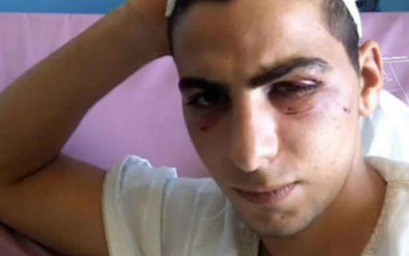 الحريات النيابية تدين اعتداء الأمن على القلالوة