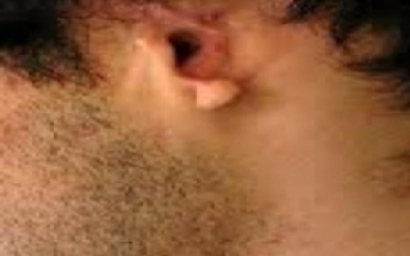 حكم بعدم مسؤولية من بتر أذن معاق بالكرك