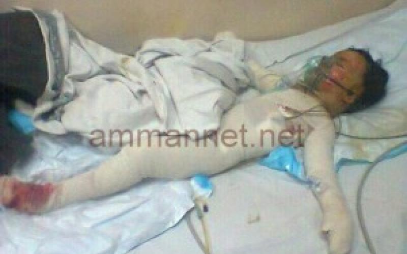 من المسؤول عن احتراق الأطفال في الزعتري ؟ - صوت