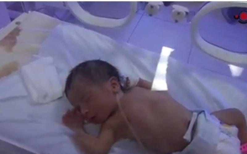 طفل سوري في الخداج 